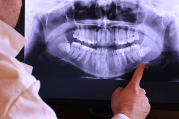 Best Emergency Dental Surgery in Louisville, KY