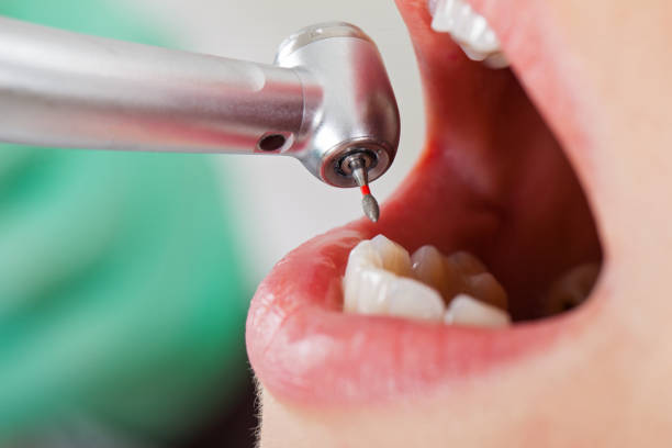 Best Emergency Dental Care for Trauma or Injury in Louisville, KY